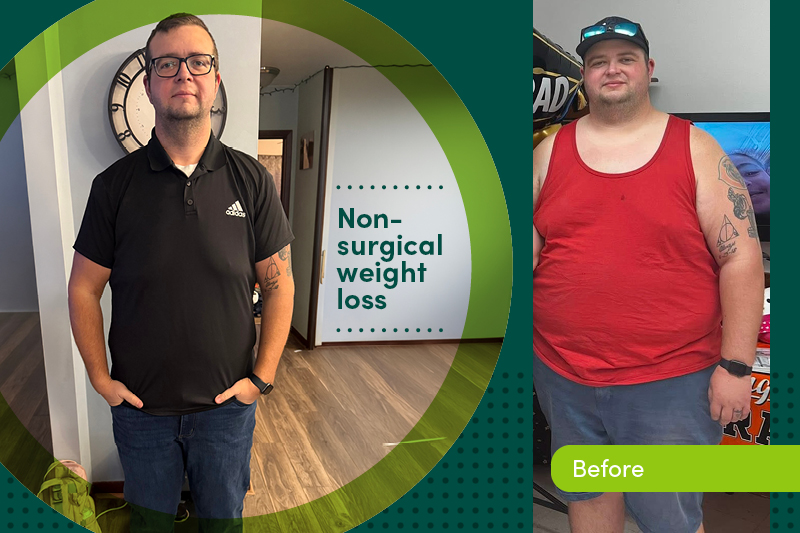 Dan Speer before and after bariatric surgery