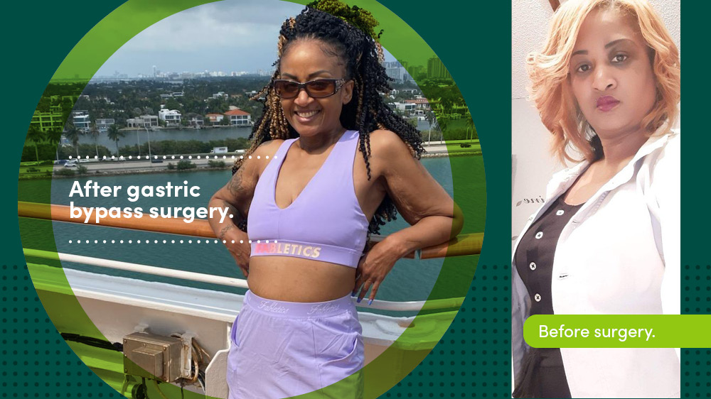 Sherretta Kipper - Bariatric Surgery